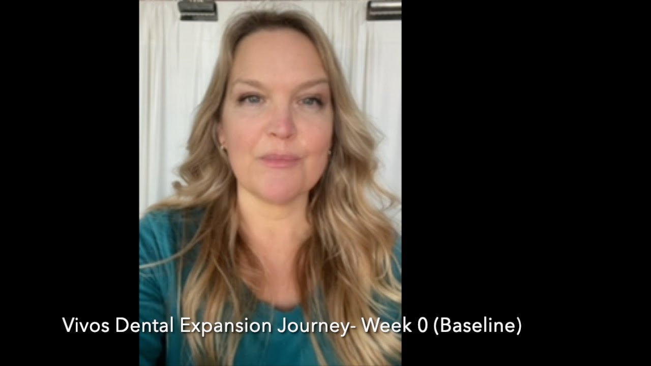 Vivos Dental Expansion Journey — Before Treatment Week 0