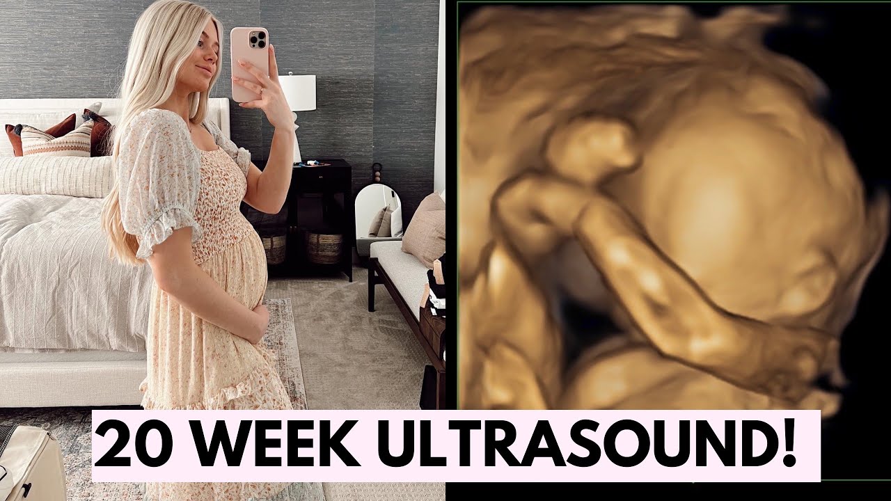 BRYNLEY'S 20 WEEK ULTRASOUND APPOINTMENT!