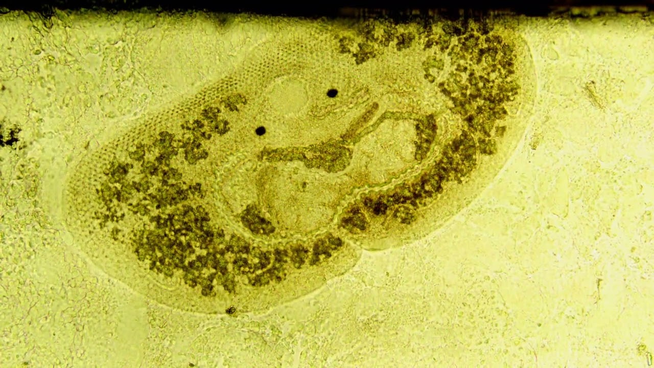 220608 Transversotrema patialense - fish ectoparasite digenetic trematode