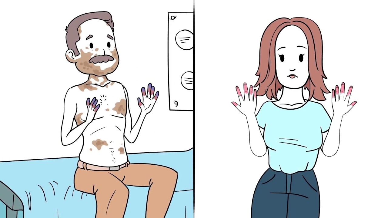 &iquest;Qu&eacute; es la esclerodermia? Sociedad Espa&ntilde;ola de Reumatolog&iacute;a