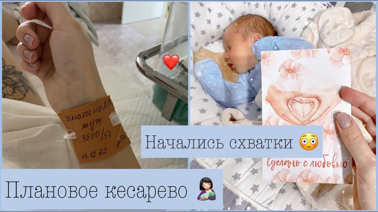 История моих родов | Плановое кесарево сечение| КС |