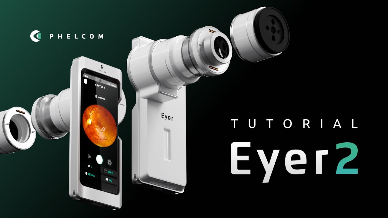 Tutorial Eyer2 - Phelcom