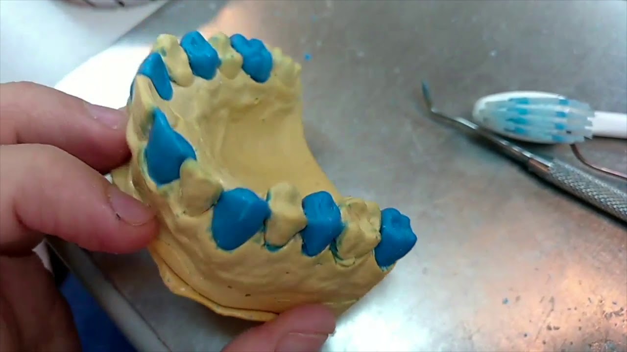 MODELADO DE PIEZAS DENTALES, CERA DENTAL