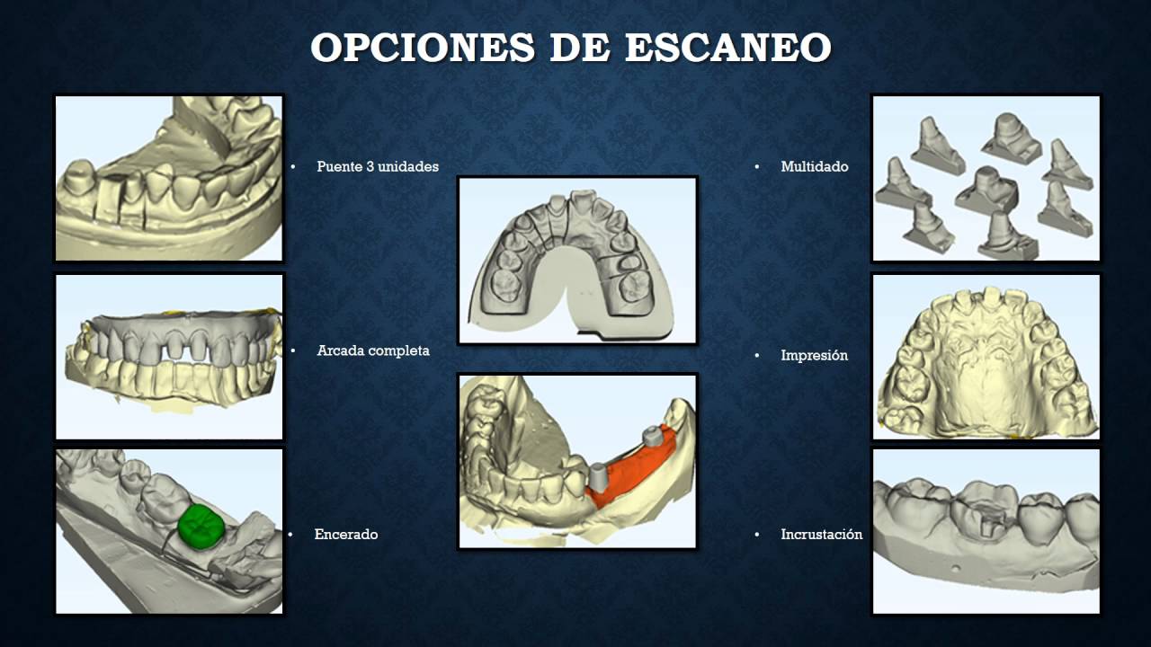 Sistema CAD/CAM Completo con MDC Dental
