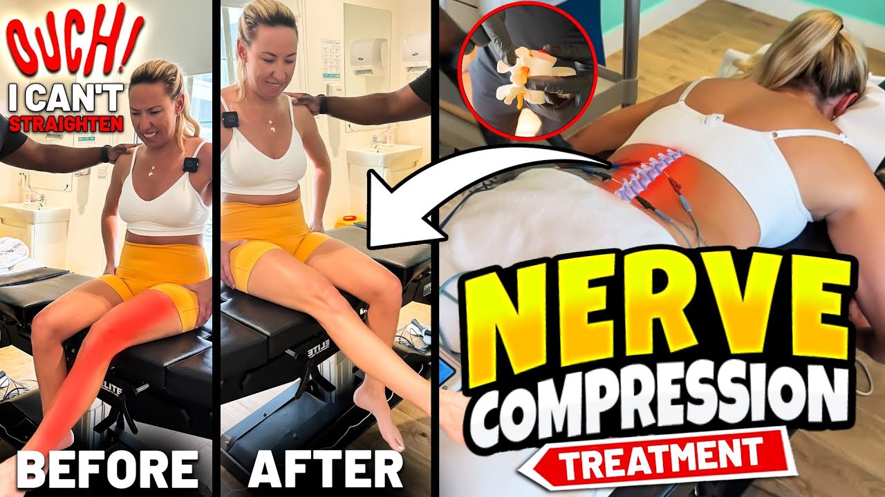 TRAPPED by Back Pain—How We Got Her LEG MOVING Again! | Chiropractic FIX by Dr. Ranen Rambrij