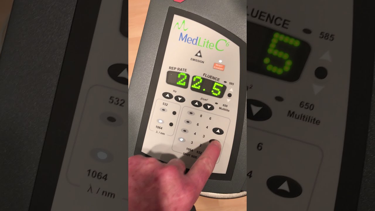 2006 HOYA ConBio Medlite C6 Laser for Sale
