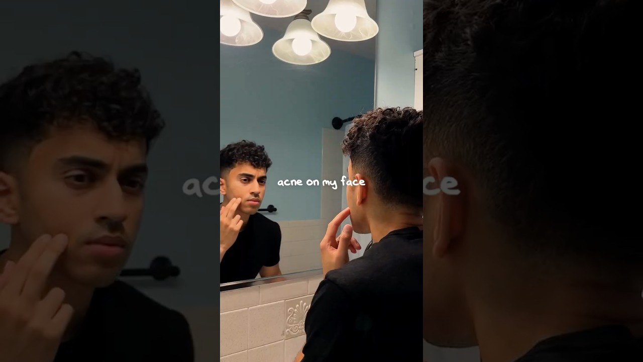 My Acne Journey