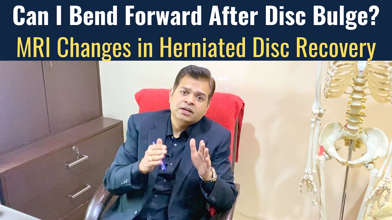 Can i Bend Forward After Disc Bulge? Herniated Disc Recovery, 3 Important Answers on Disc Bulge
