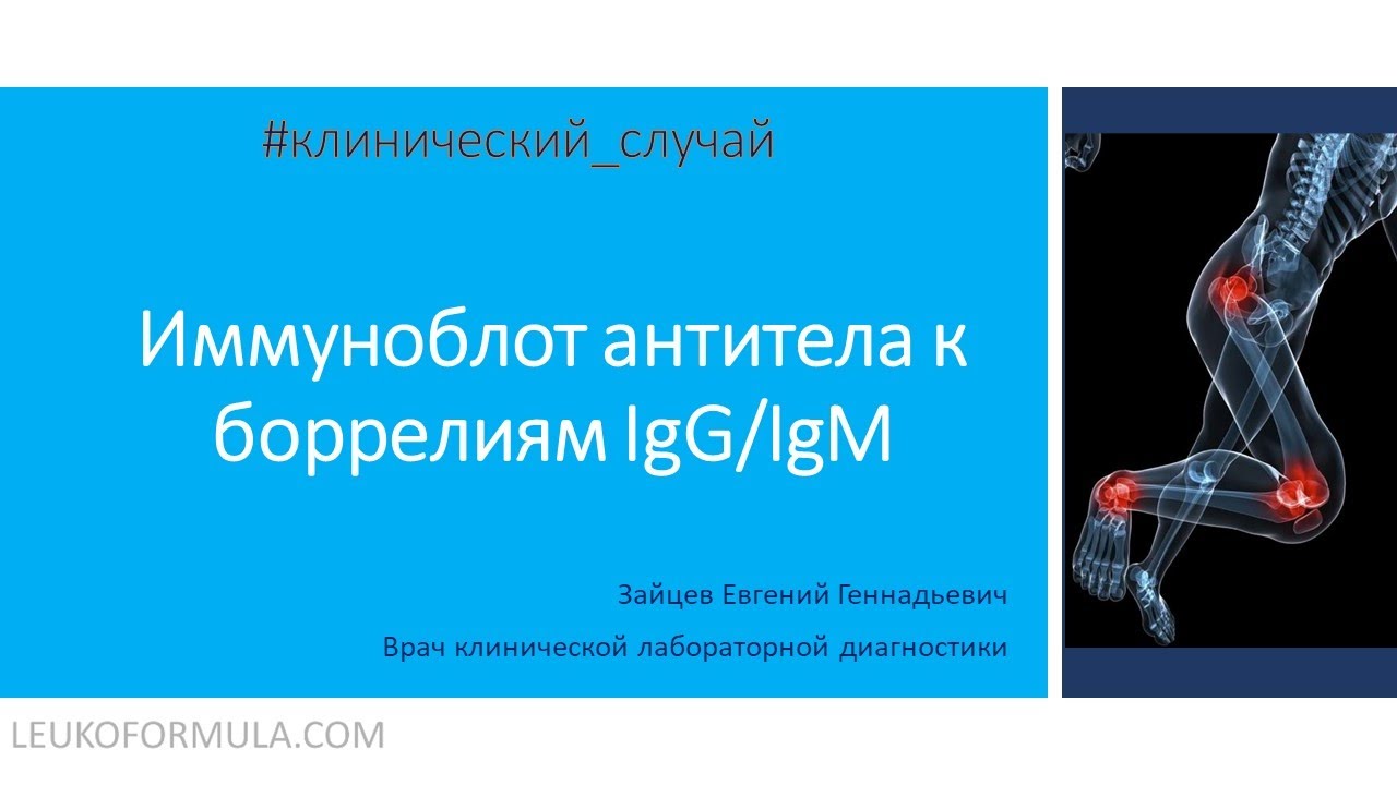 3. Иммуноблот антител к боррелиям (Borrelia, IgM и Borrelia, IgG). Интерпретация.