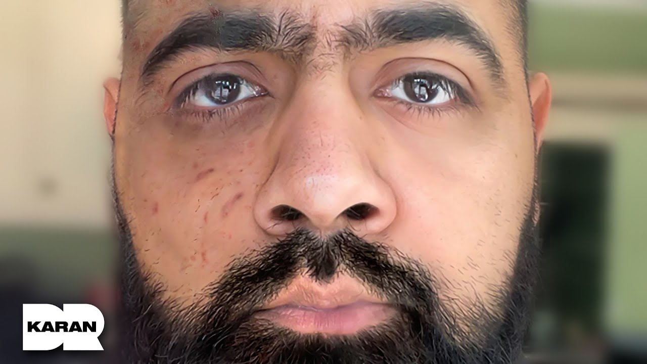 The Only Skincare Routine You Actually Need | Dr Karan