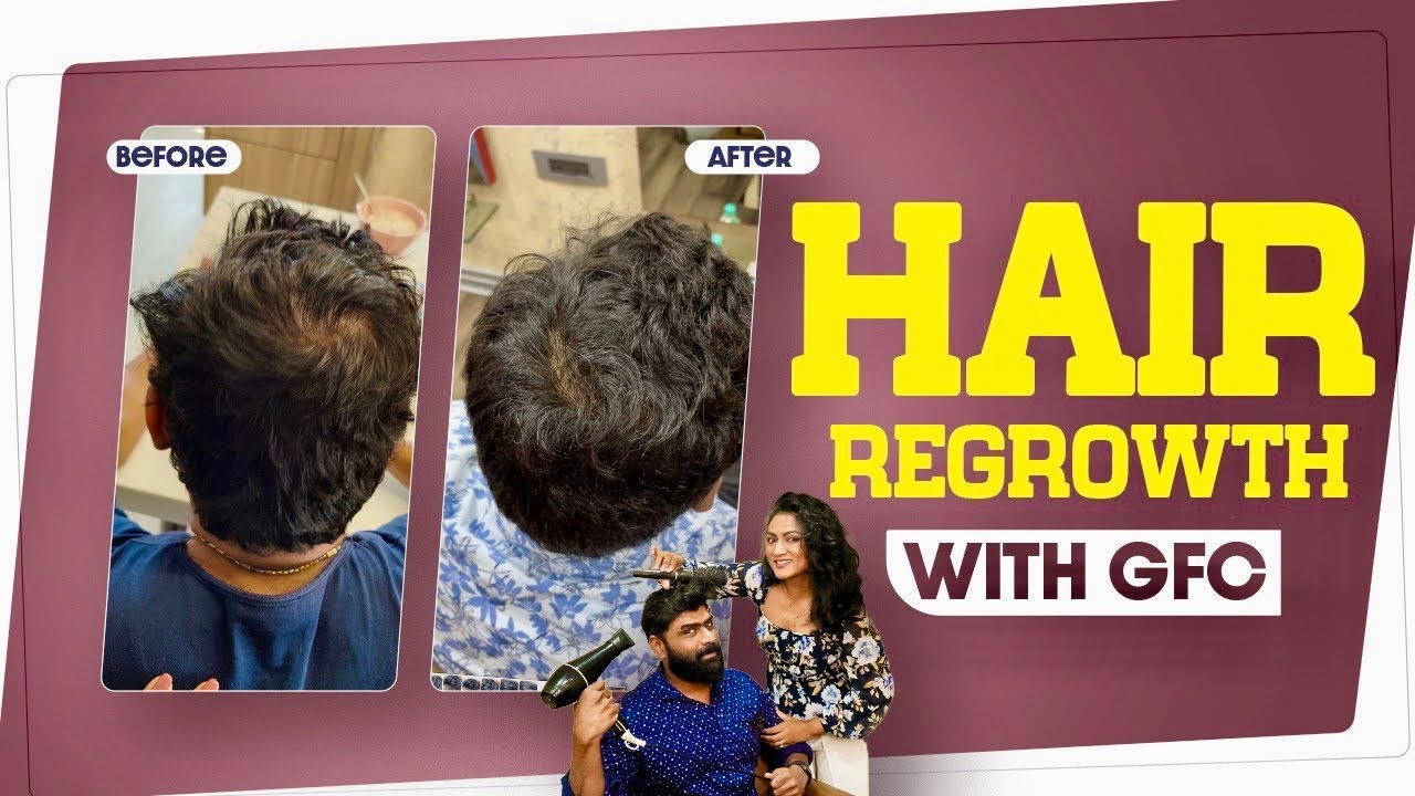 GFCతో అద్భుతమైన జుట్టు తిరిగి పొందండి! || COST MENTIONED IN VIDEO || Ashtrixx
