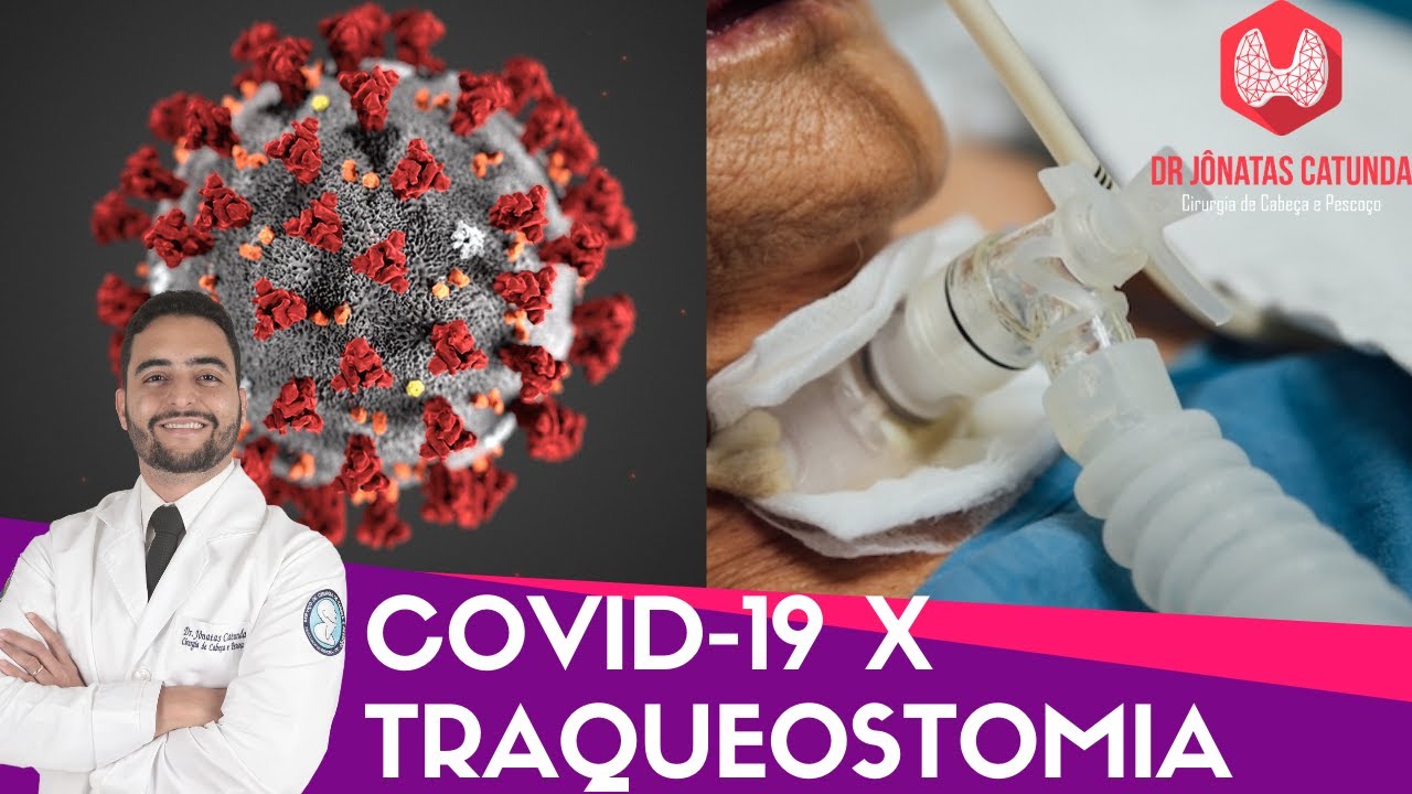Traqueostomia X Covid-19 - Riscos, indicações, como é feito, possíveis complicações