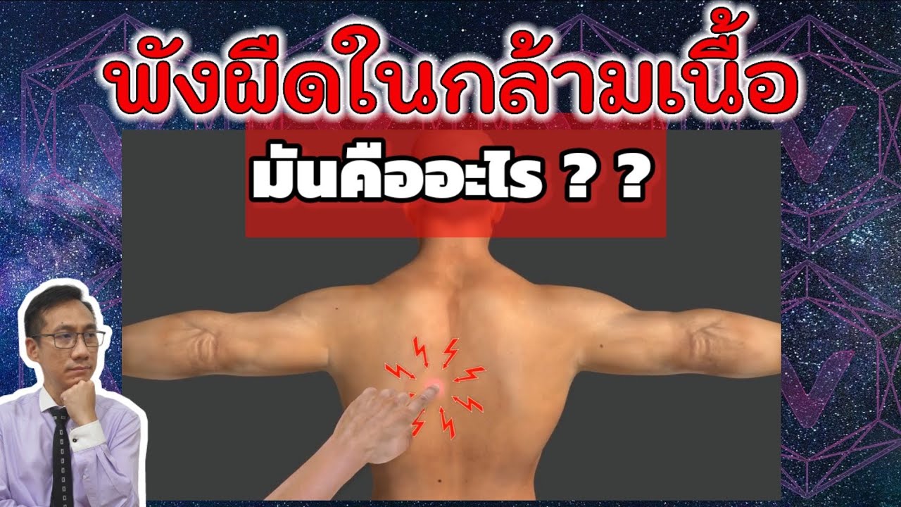 พังผืดในกล้ามเนื้อ ตอนไปนวด คืออะไร ? ? ?