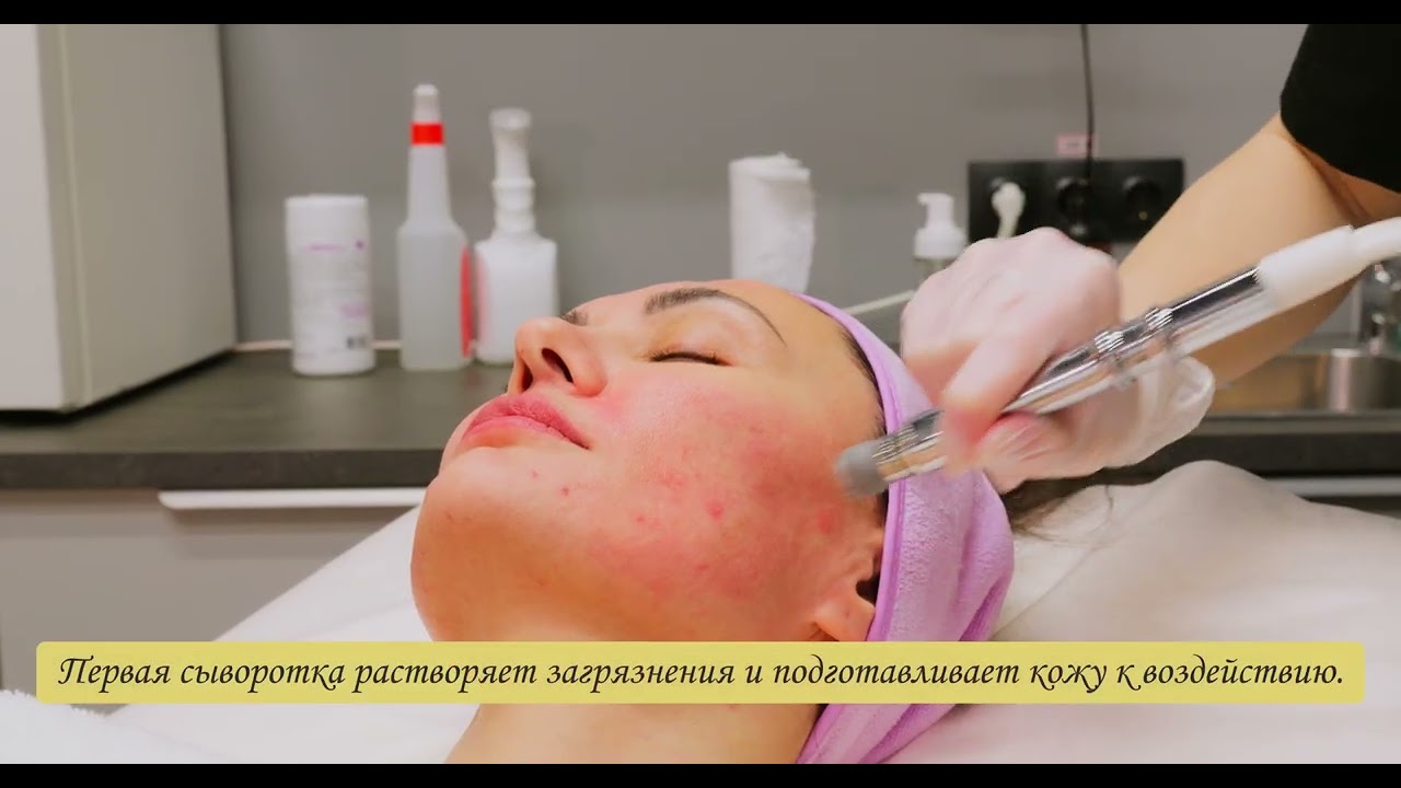 Aquarure II Аппаратная чистка. Нужно ли делать?