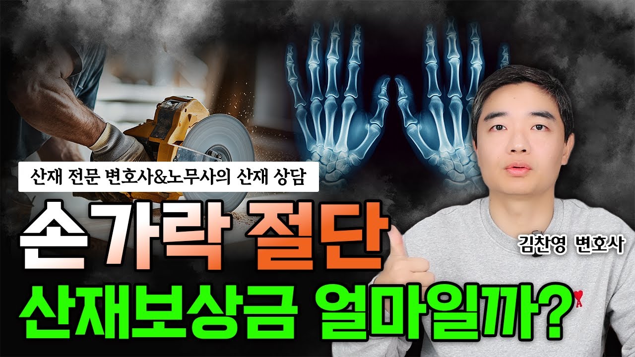 손가락 절단 사고 산재보상금 안내 l 추가 보상 l 손해배상 청구 l 근재보험 #산재 #산재전문변호사