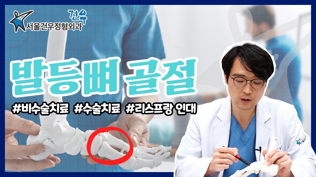 발등이 붓고 아프다면 이 질환을 의심하세요!