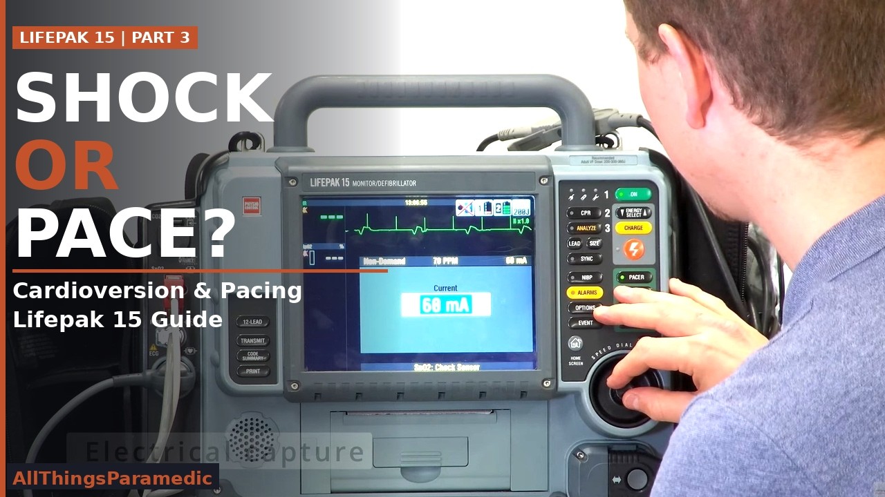 Lifepak 15 Часть 3: Электрокардиостимуляция и кардиоверсия