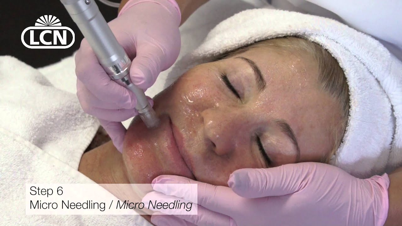 Micro Needling Tutorial mit dem Mobile Pen und Tipps von LCN