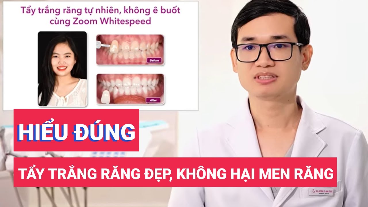 Hiểu đúng về tẩy trắng răng: Đẹp hơn mà không hại men răng