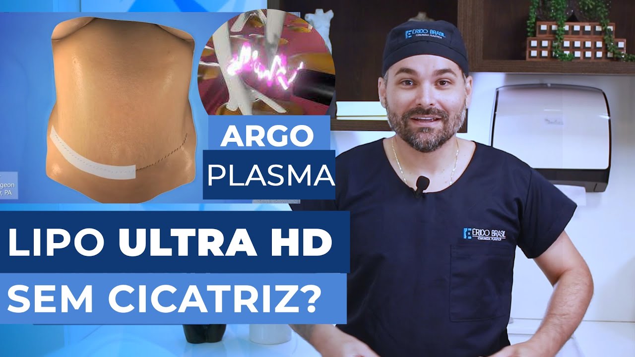 LIPO HD e Lipo Ultra HD com ArgoPlasma