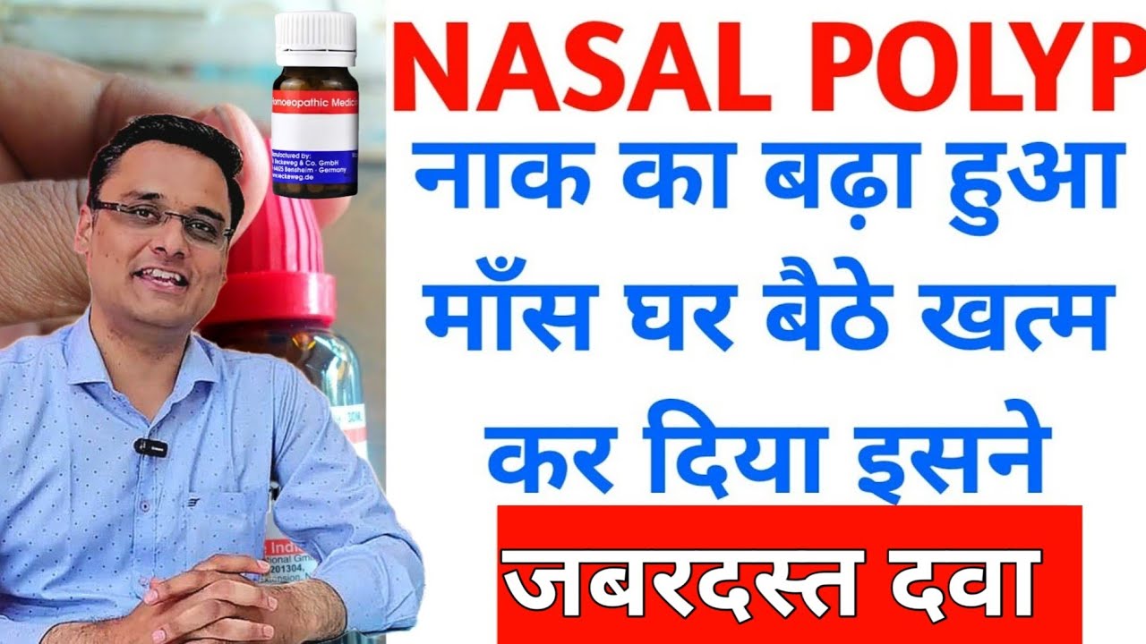 nasal polyp। नाक का बढ़ा हुआ माँस ठीक करने वाली दवा।