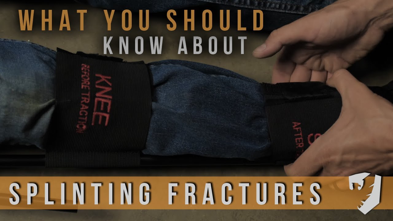 Splinting Fractures - Vacuum splints, traction splints, improvising and more