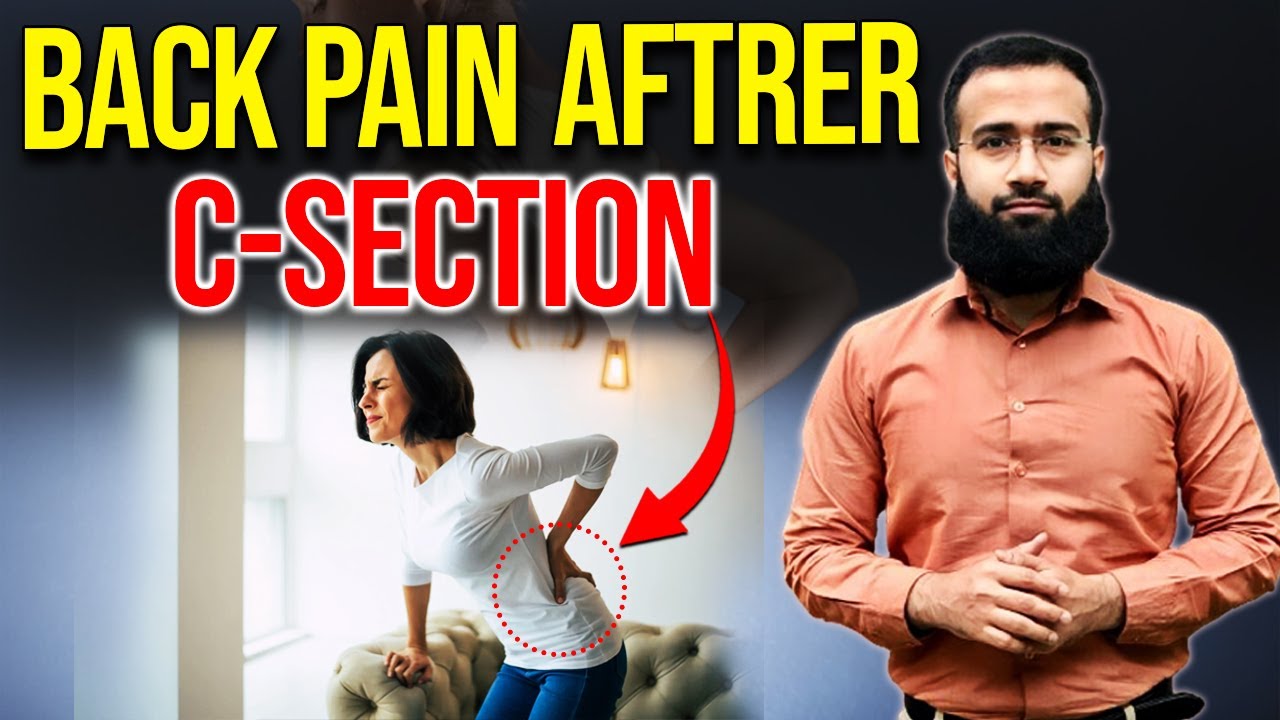 Back Pain after C Section | Postpartum Lower Back Pain