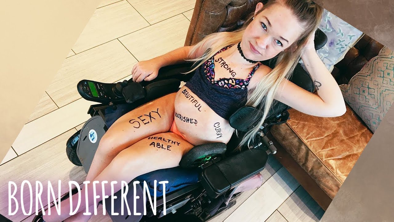 I’m Disabled AND Sexy | BORN DIFFERENT