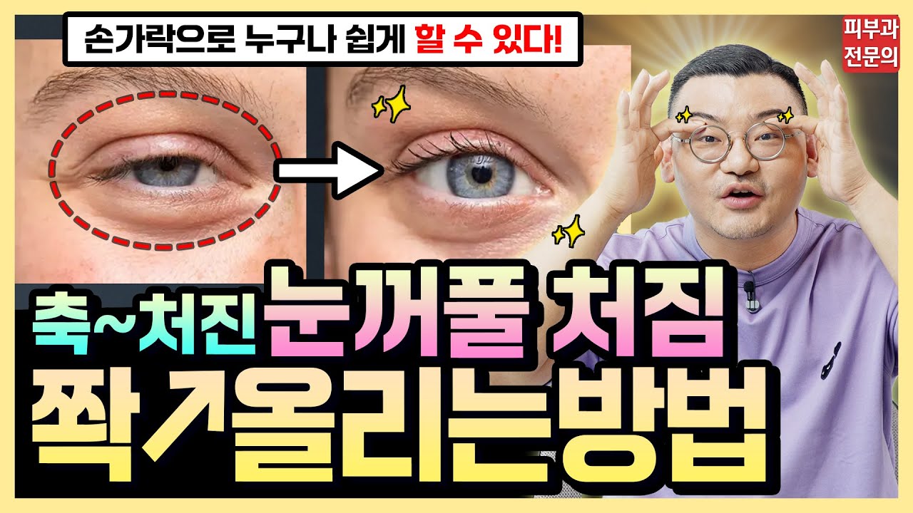 딱 3분!! 처진 눈꺼풀 올리고 눈👁️커지는 확실한 방법 | 피부과전문의도 매일하는 눈꺼풀 리프팅 운동법!
