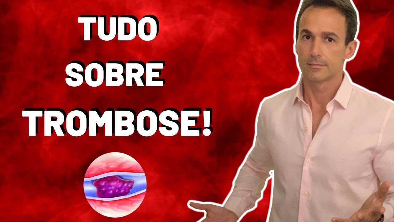 Tudo sobre Trombose! (IMPERDÍVEL!!!)