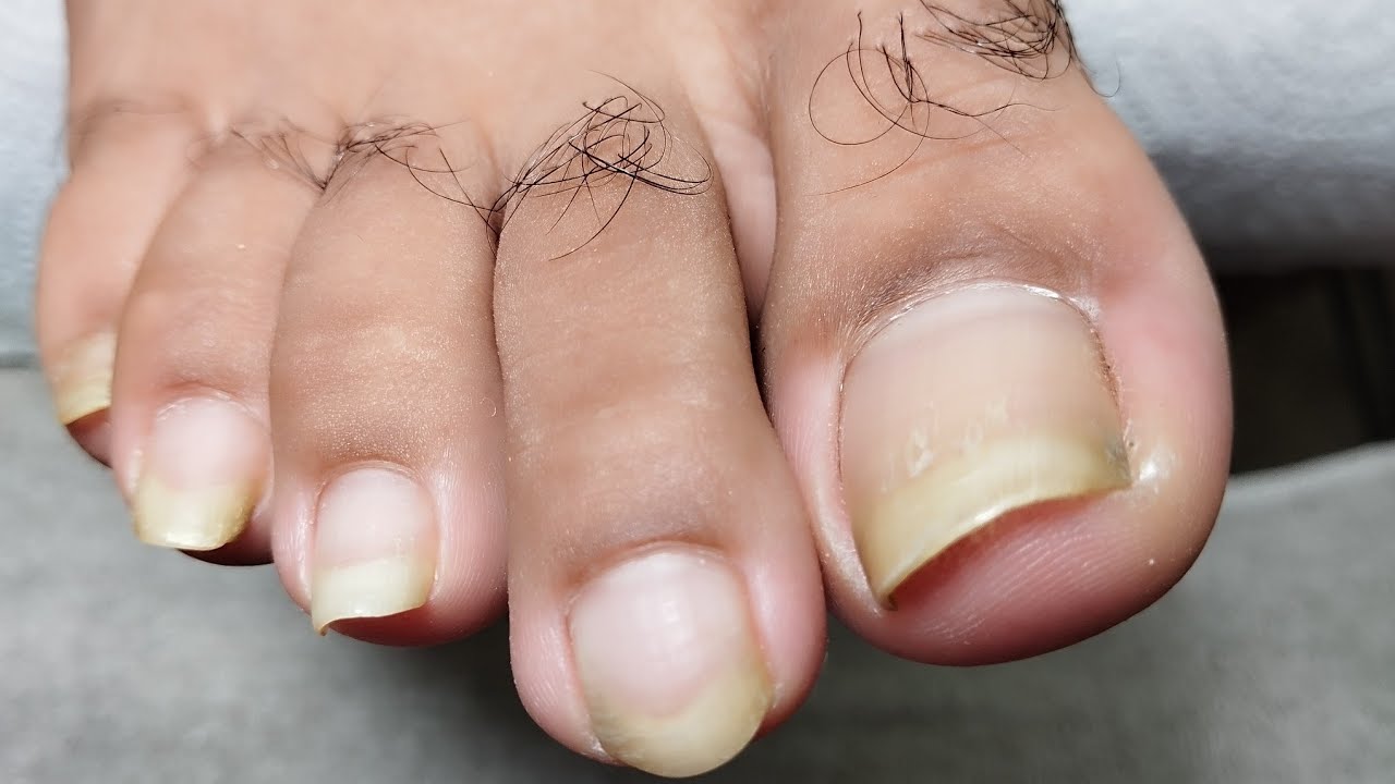 limpieza de uñas largas de los Pies 👣