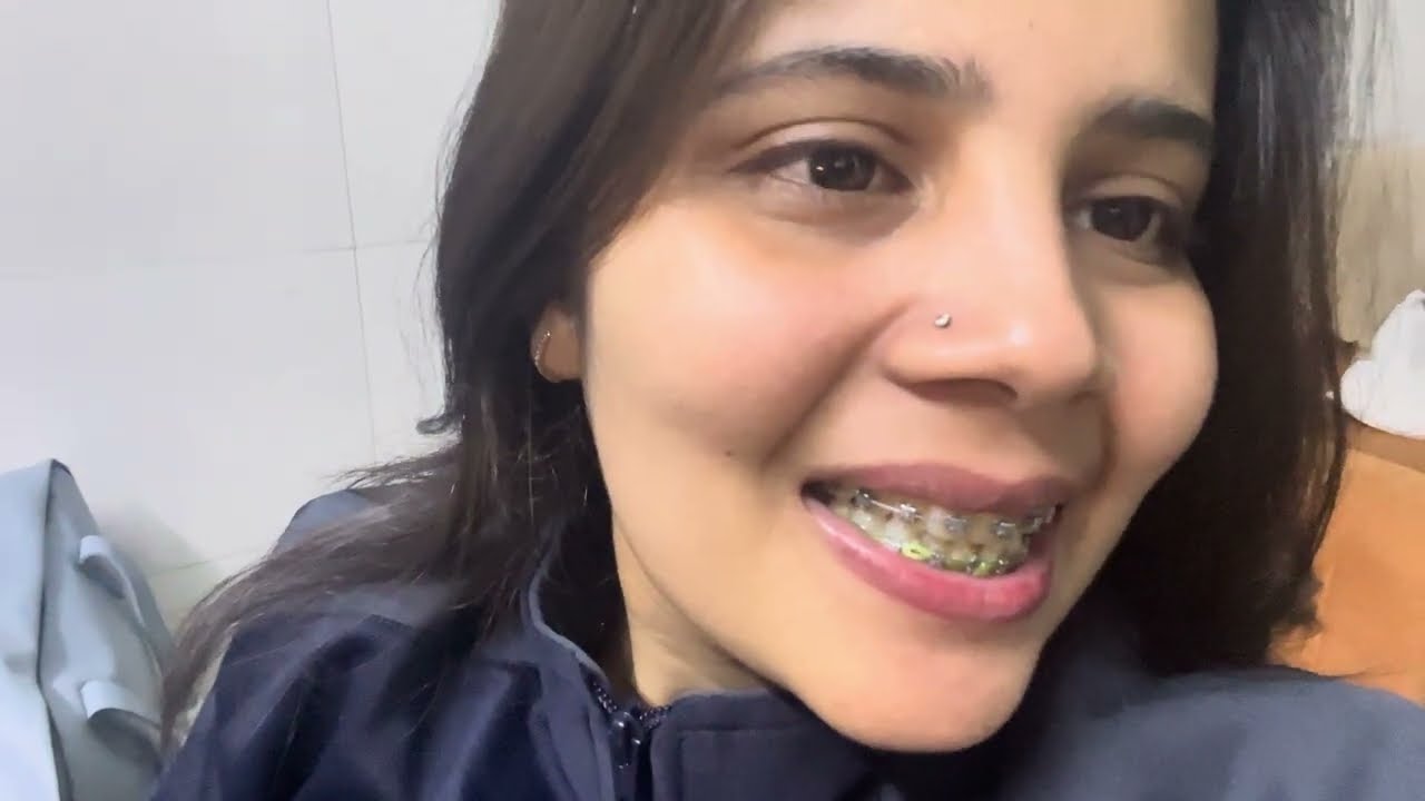 11 Months 3 day braces update #viral #trending #dentalcare #teeth #smiledesigndental #viralvideo #yo