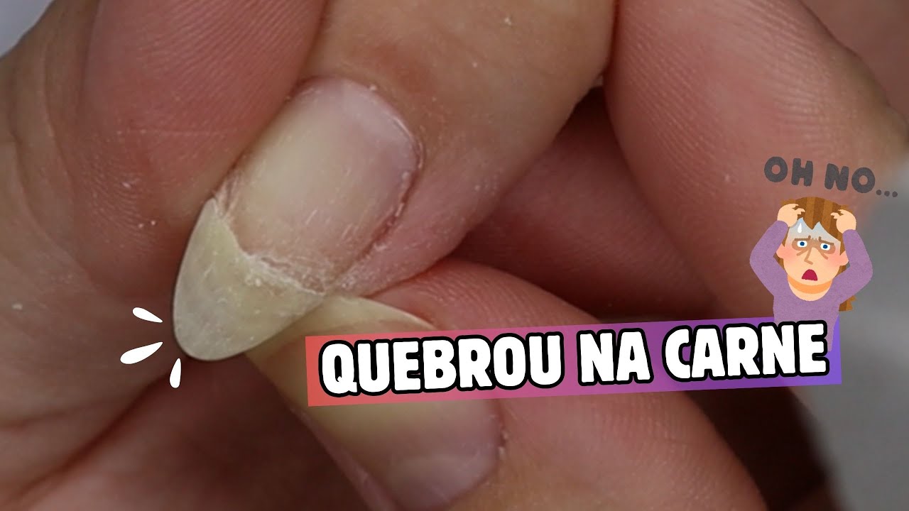 FIZ REMENDO COM BASE EM GEL NA MINHA UNHA