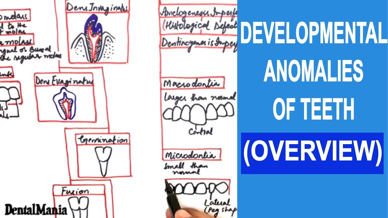 Developmental anomalies of teeth - Overview [ ALL ANOMALIES COVERED in a SINGLE video]