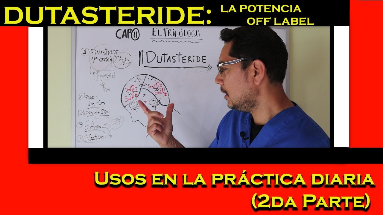 DUTASTERIDE: Usos en la práctica diaria