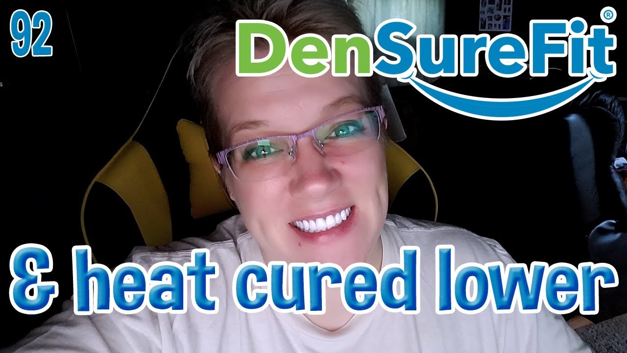 Heat-Cured Acrylic and DenSureFit on Lowers