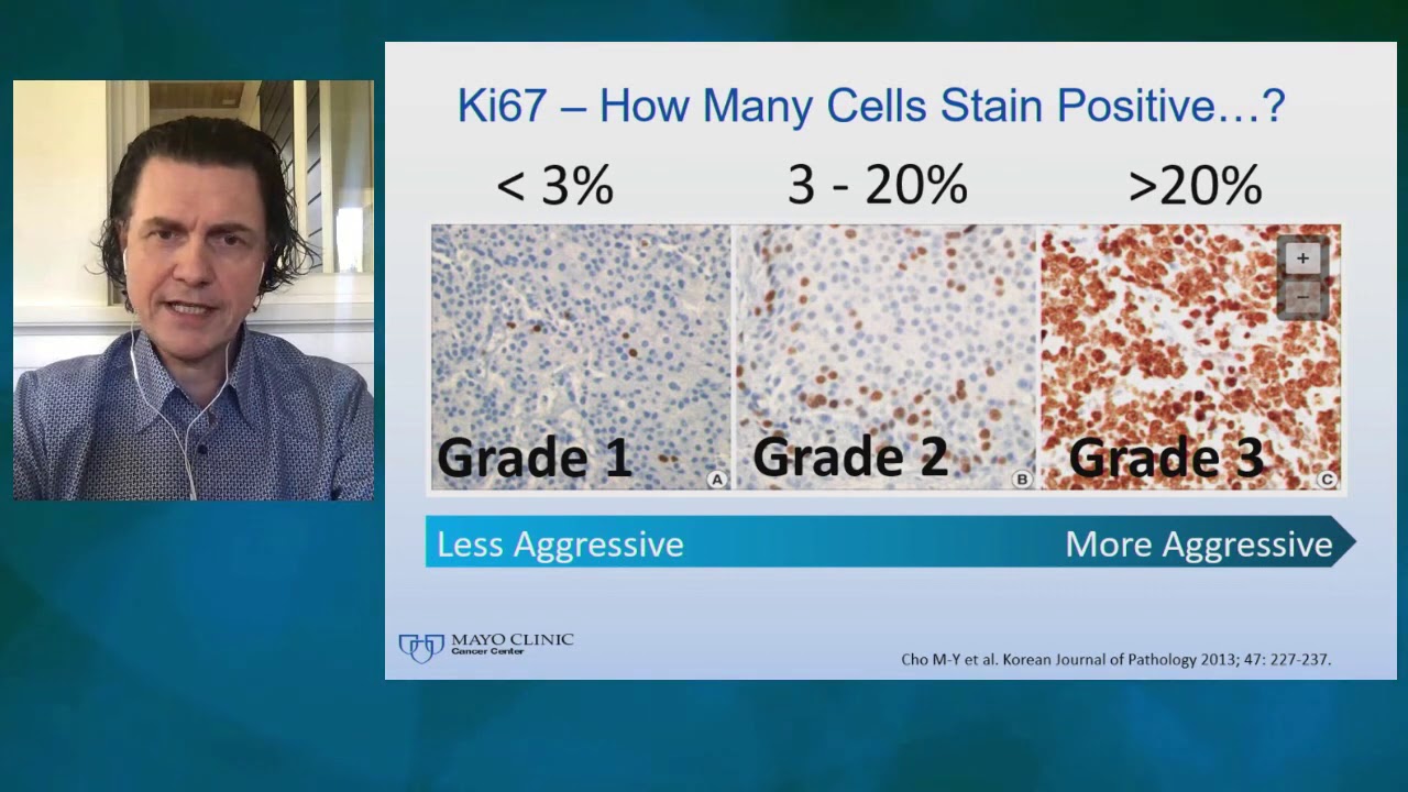 Neuroendocrine Neoplasms -Thor Halfdanarson