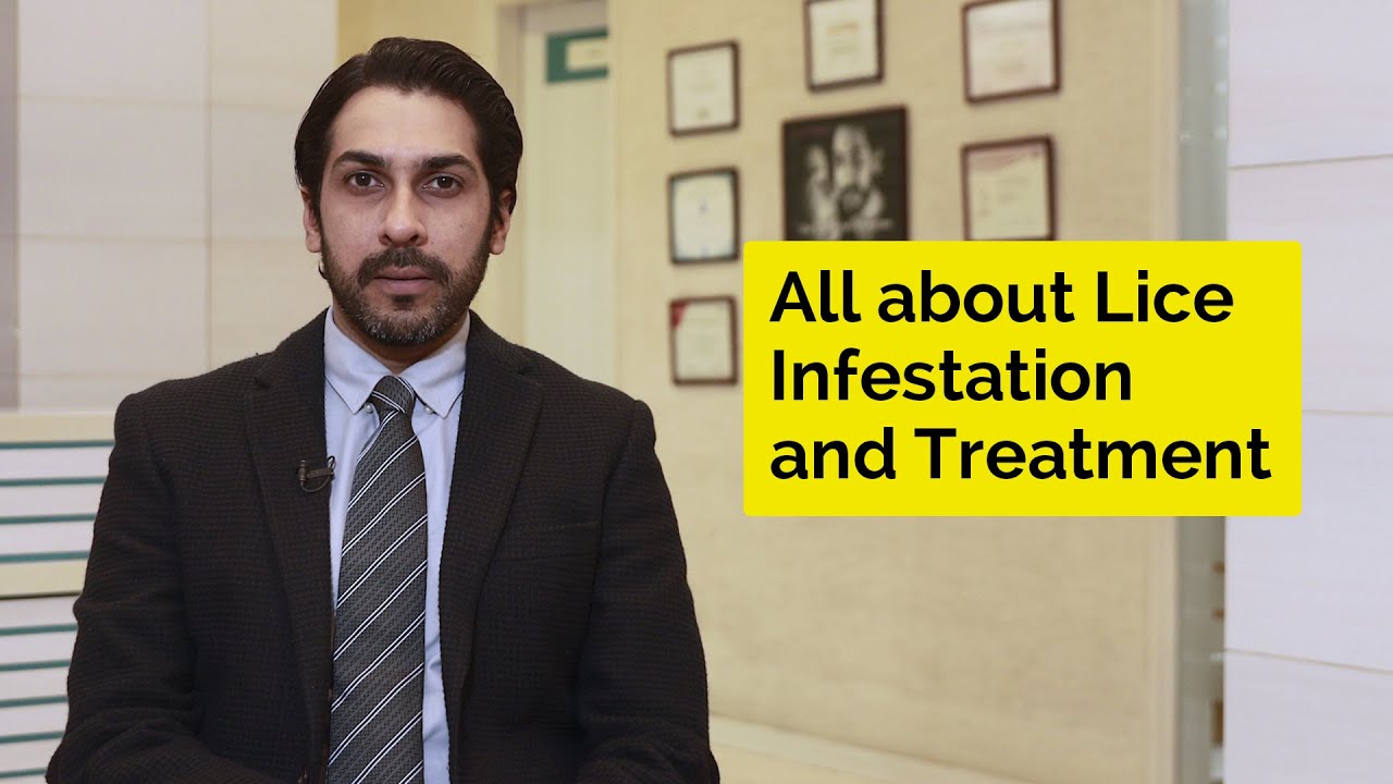 All About Lice Infestation and Treatment | Skin Diaries