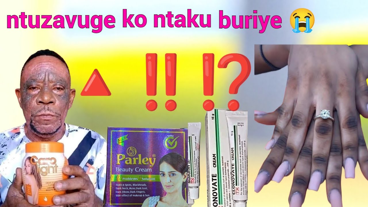 Ntuzavuge ko ntakuburiye😘 nimabi kuyisiga mutabanje kumenya ibi⁉️‼️