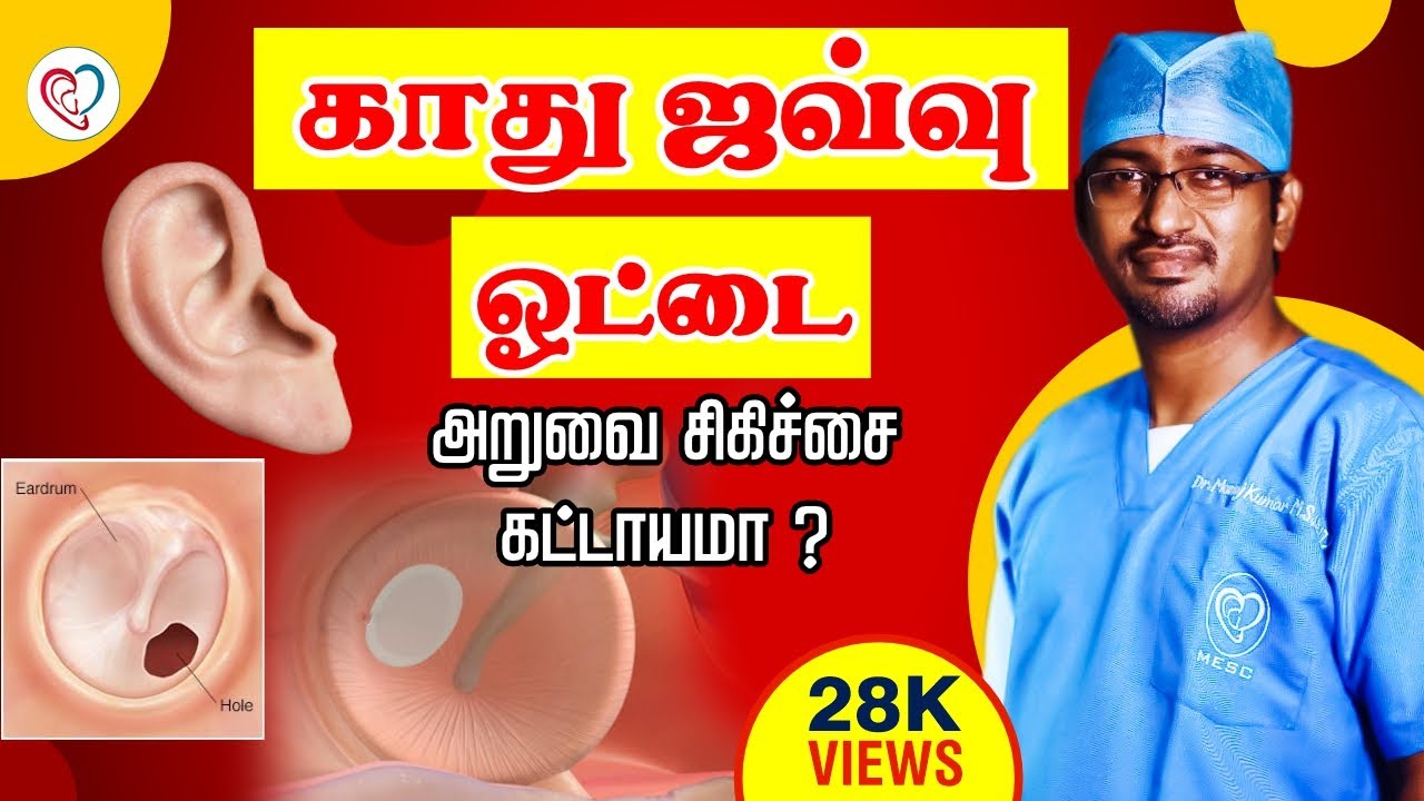 காது ஜவ்வு ஓட்டை-அறுவை சிகிச்சை கட்டாயமா ? | Ear drum perforation | Dr. Manoj ENT Speciality Centre