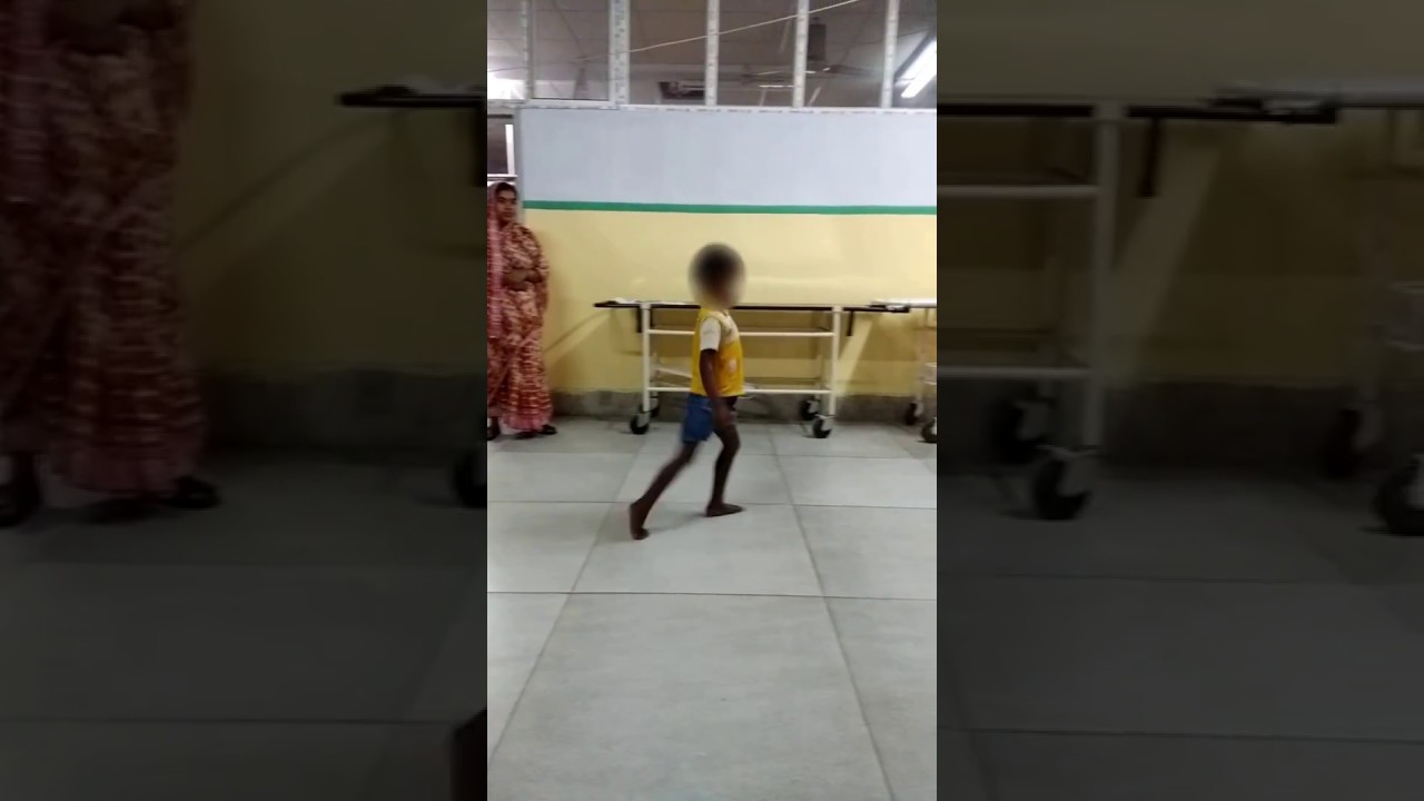 7yr/Male with Right Hemiplegic Cerebral Palsy - Pre-Op Video 2