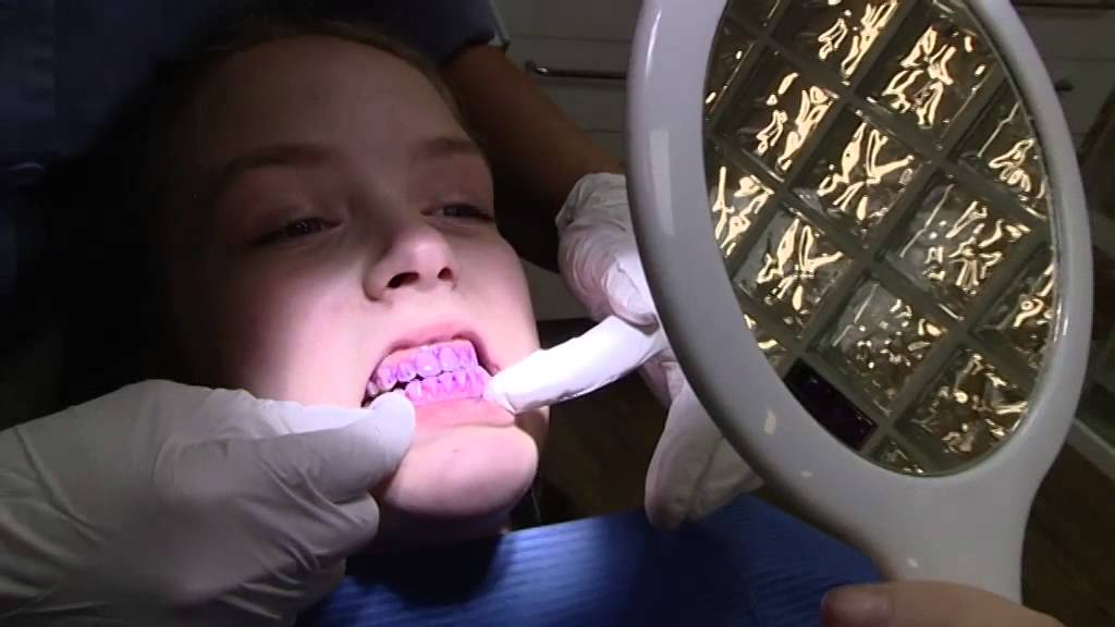 NVV Mondhygieniste