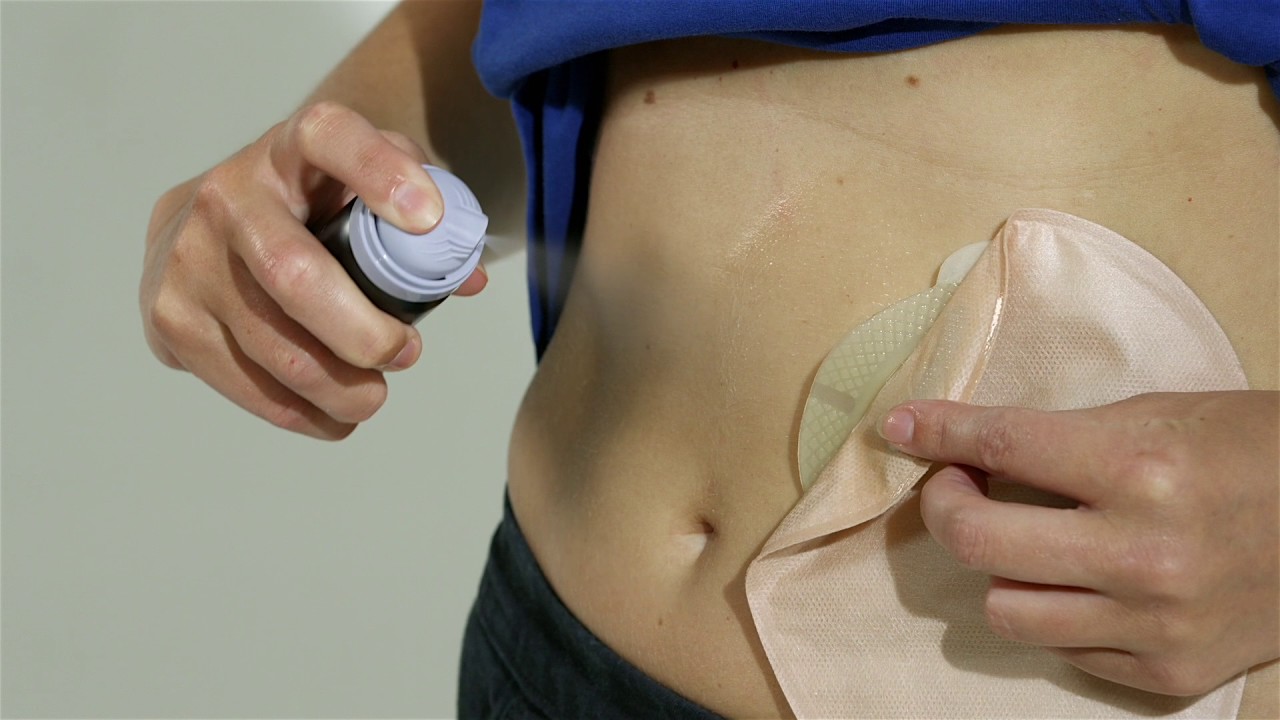 Trio Elite Adhesive Remover