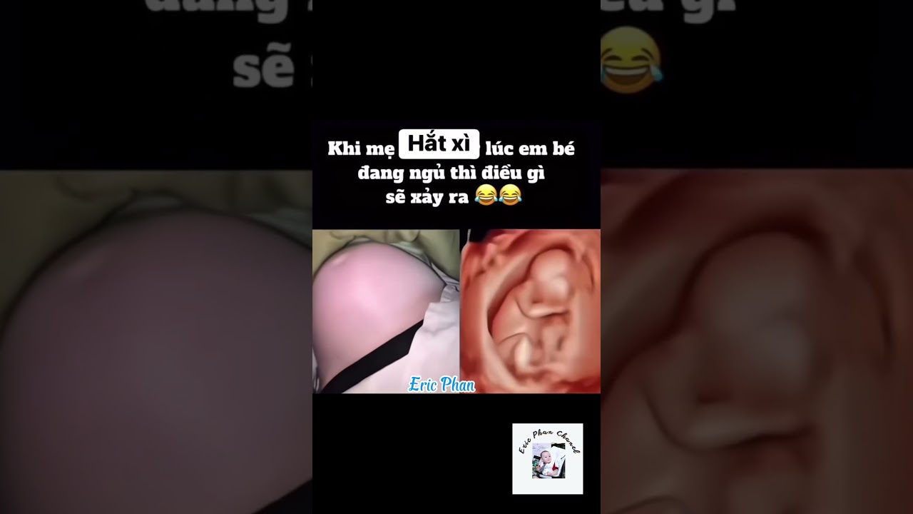ĐIỀU GÌ XẢY RA KHI MẸ BẦU HẮC XÌ 