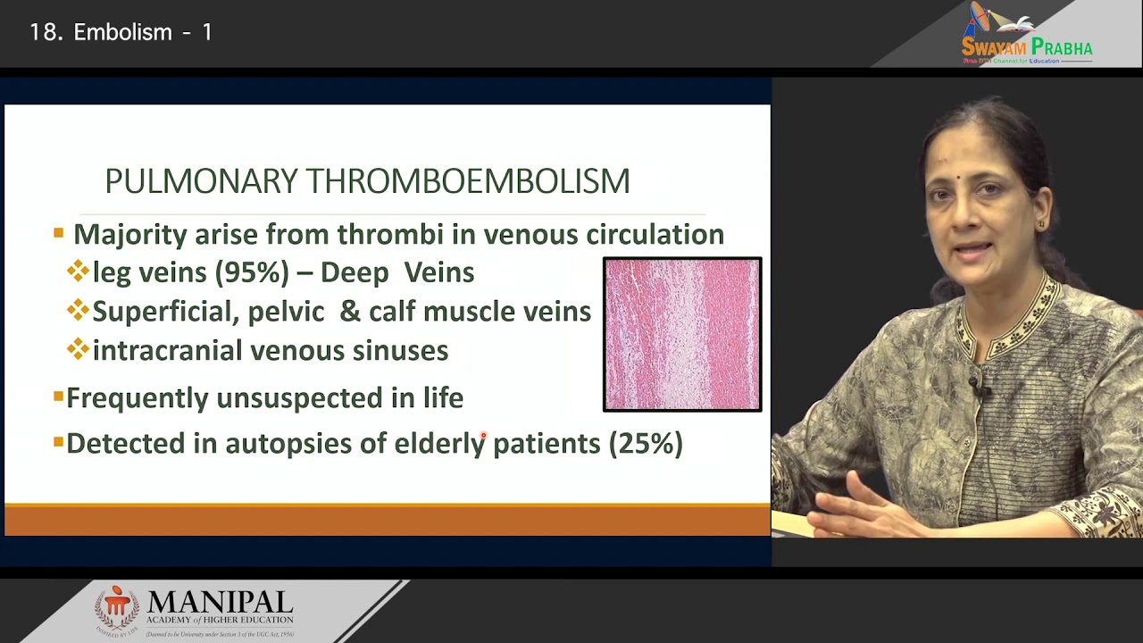 Embolism- I