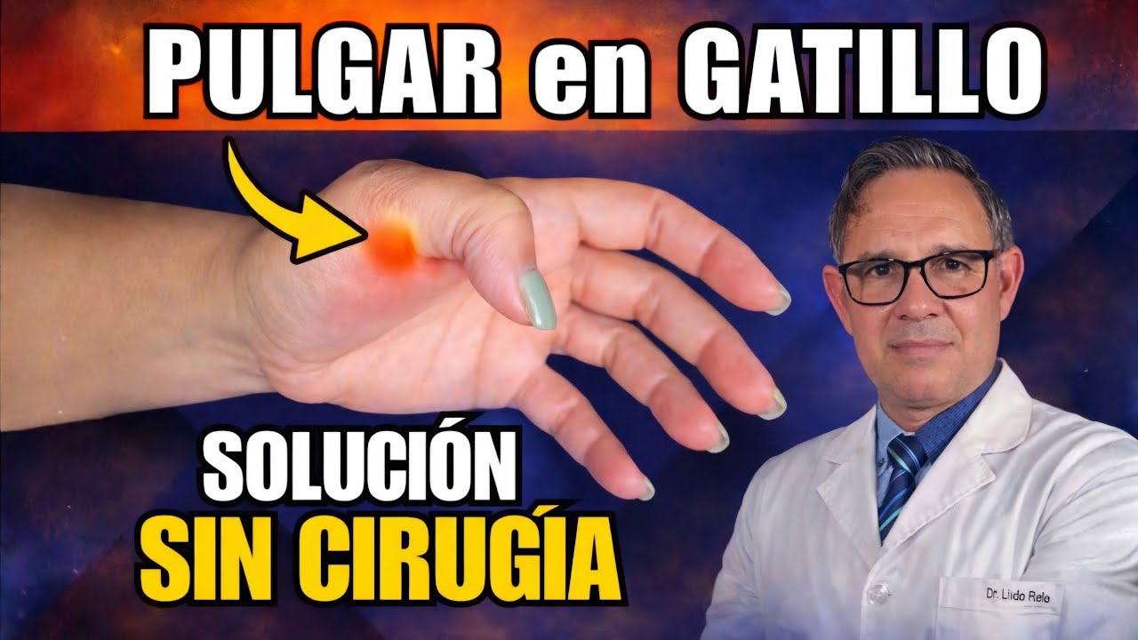 PULGAR en GATILLO o resorte - TRATAMIENTOS más EFECTIVOS  en 2026
