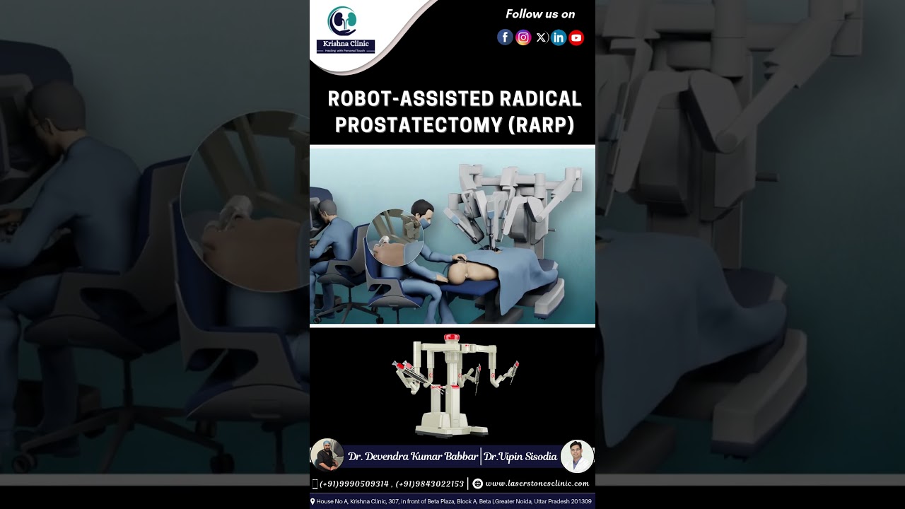 Robot-Assisted Radical Prostatectomy (RARP) | Advanced Prostate Surgery Explained