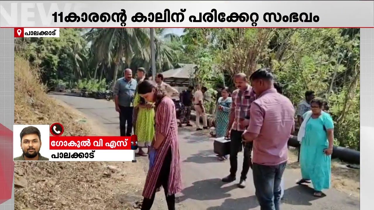 കുട്ടിക്ക് പരിക്കേറ്റത് പന്നിപ്പടക്കം പൊട്ടിത്തെറിച്ച്;കണ്ടെത്തല്‍ ഫോറന്‍സിക് പരിശോധനയില്‍ |Palakkad