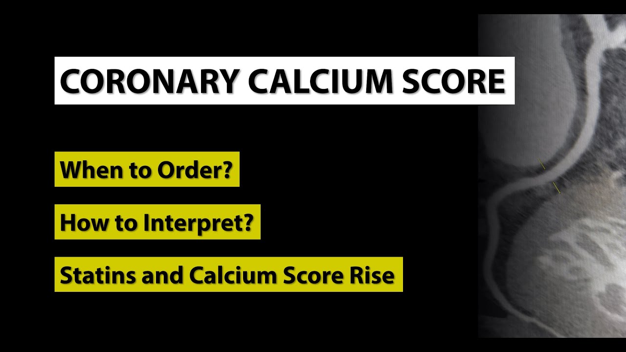 Coronary Calcium Score Test, Statins and the Risk of Heart Attack (When to use and How to interpret)