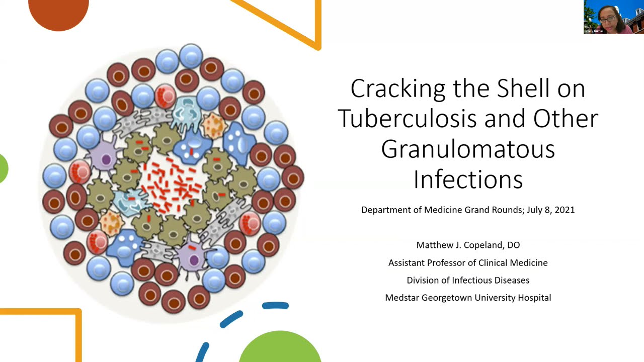 Cracking the Shell on Tuberculosis and Other Granulomatous Infections